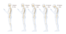 This chart shows the stress put on the neck and spine as a result of hunching over a smartphone (Courtesy Dr. Ken Hansraj M.D.)