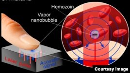 Device Finds Malaria Infections in Seconds