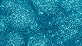 New Brain-Image Database Could Assist Chronic Pain