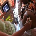 Study Finds Drop in Deaths of Mothers in Developing World