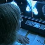 Breast Cancer Study Could Change How Early Growths Are Treated